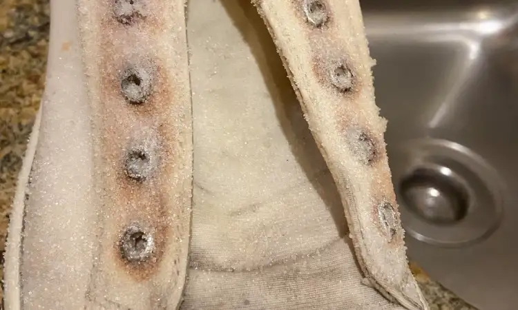 Noda karat pada sepatu, Sumber: reddit.com