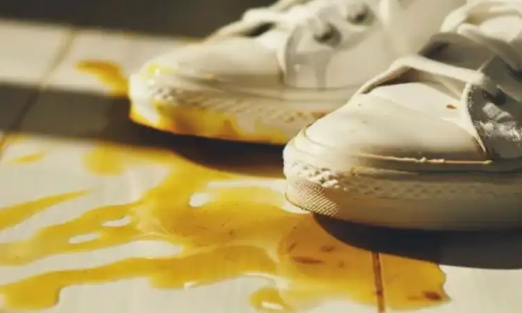 Noda minyak, Sumber: digitaloceanspaces.com