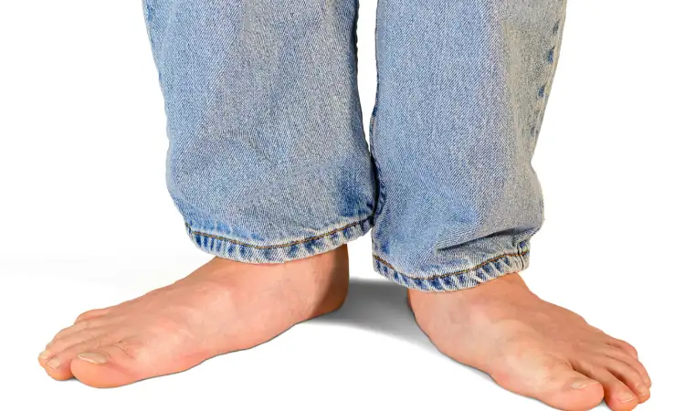 Sepatu untuk flat foot, Sumber: prismic.io